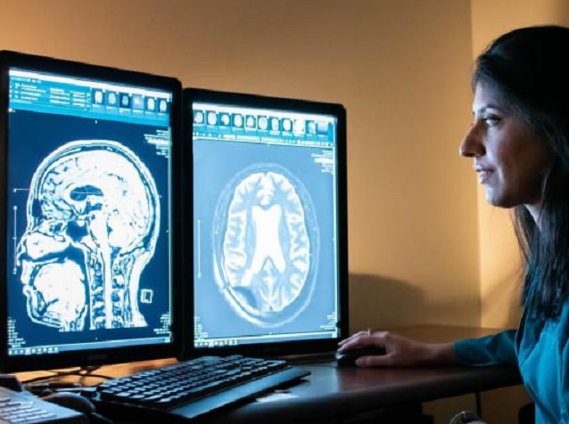 Áttörést értek el az Alzheimer-kór kutatásában