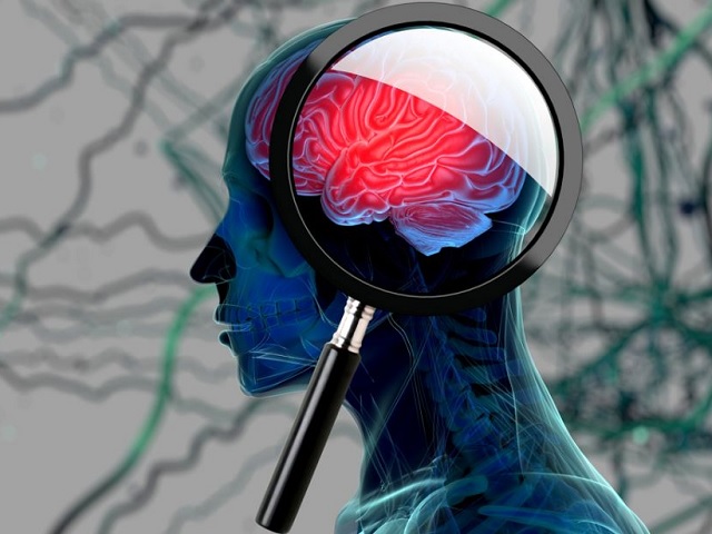 Gyógyítható lehet az Alzheimer-kór