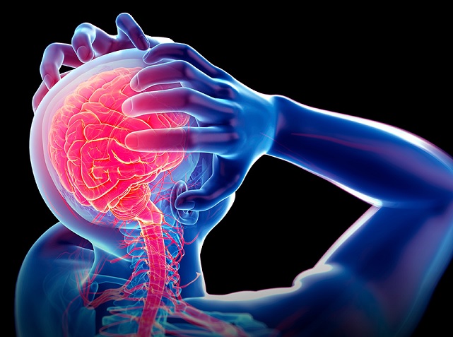 Megállítható lehet a gyulladás Alzheimerben