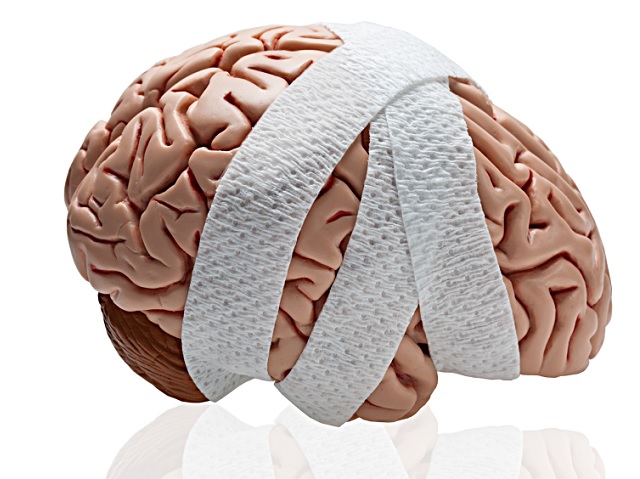 Fejsérülés siettetheti az Alzheimert